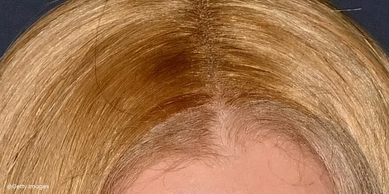 wigs for women