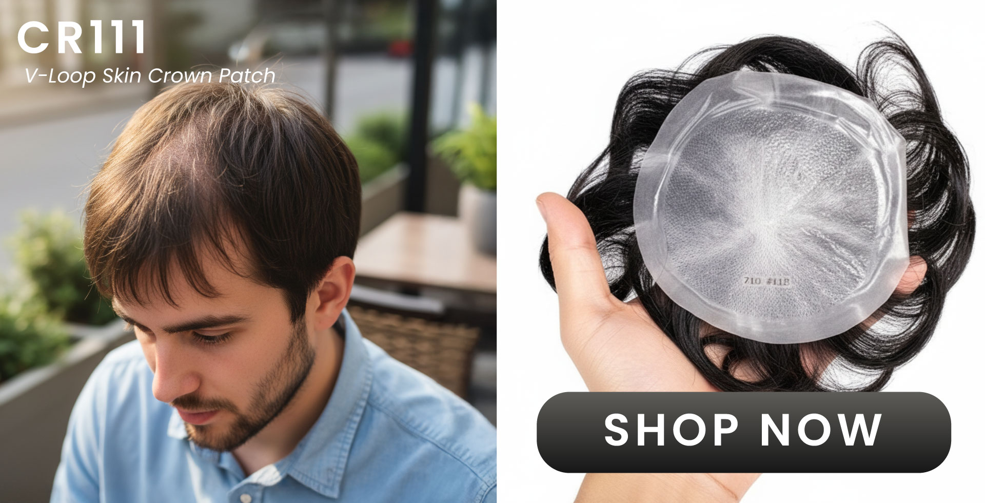 CR111 V-loop Skin Crown