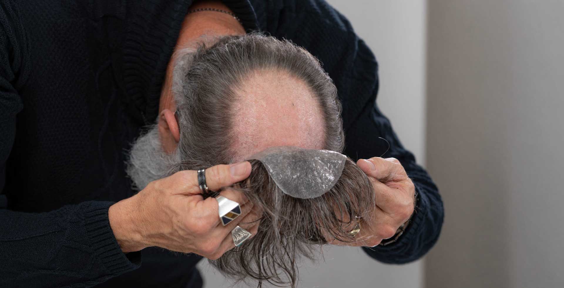 attaching the hair system back