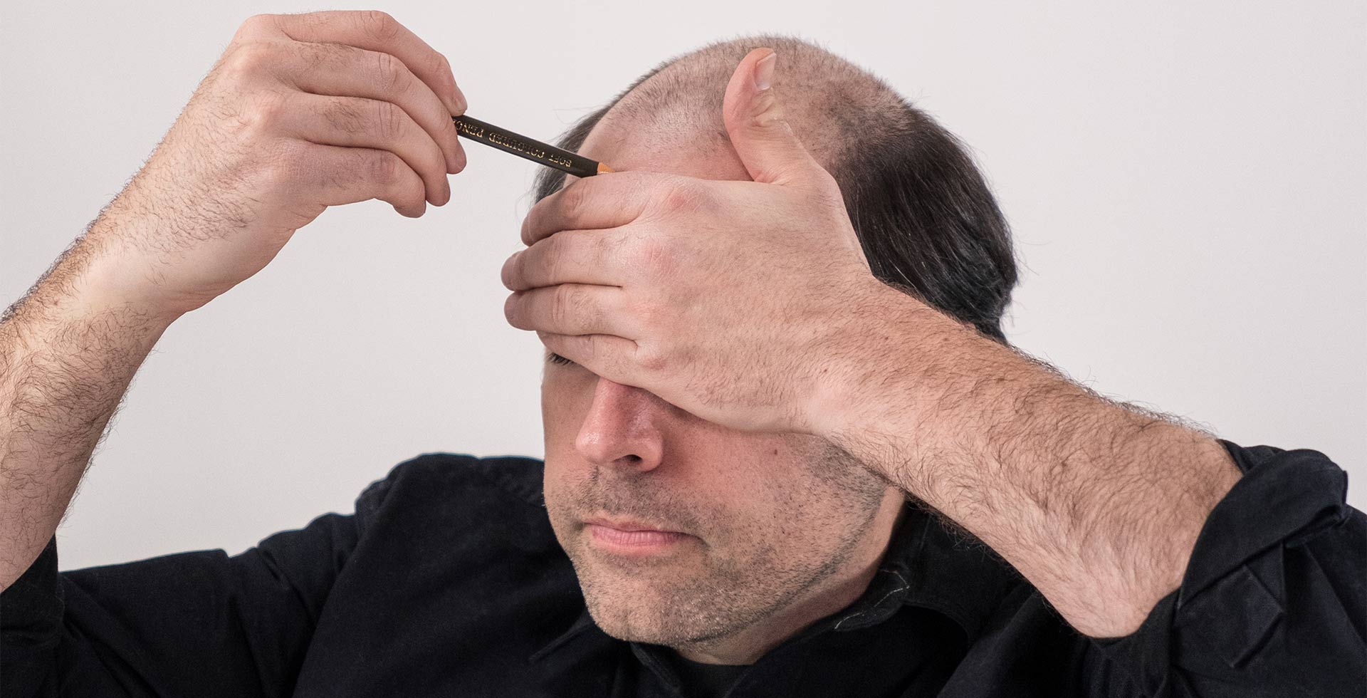 prepare the scalp