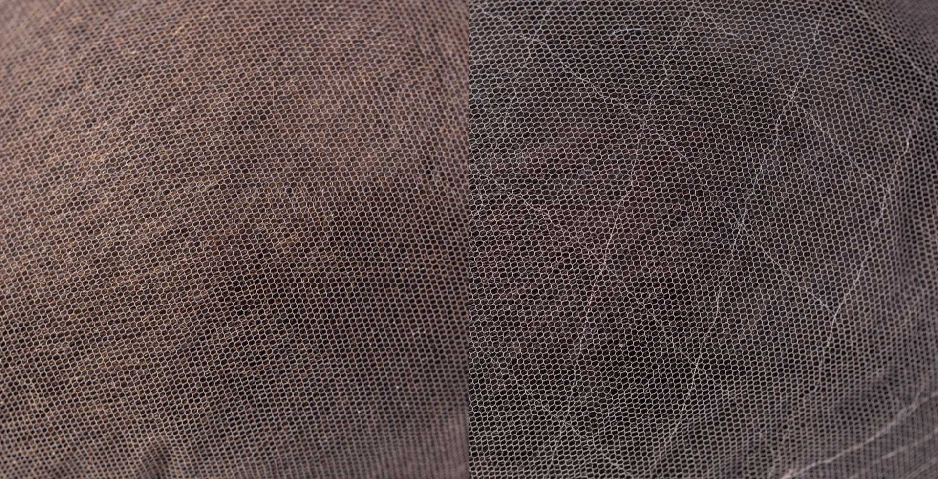 What Is a Lace Hair System