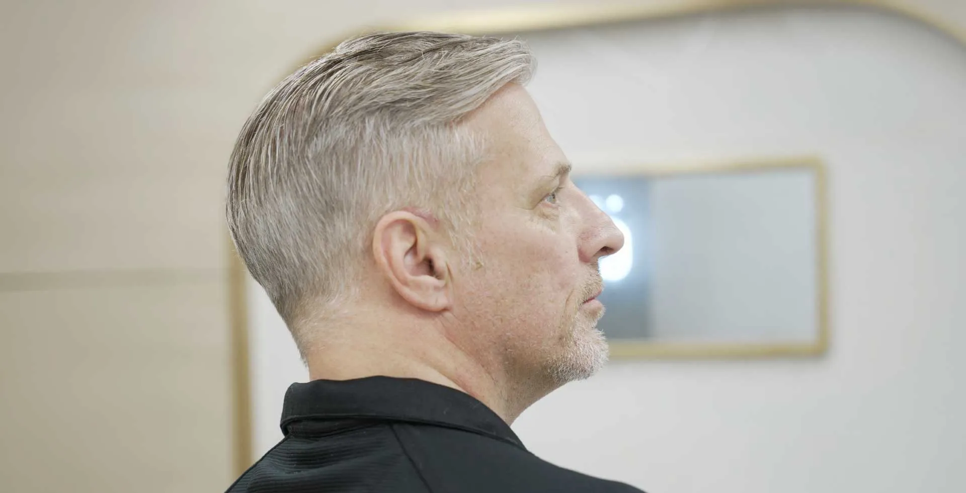 Why Men Choose Low Density Hair Systems