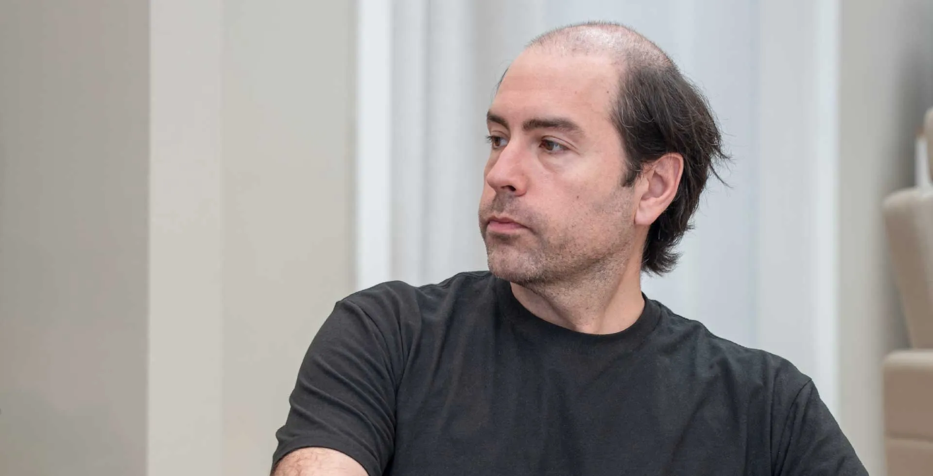 How common is hair loss in men