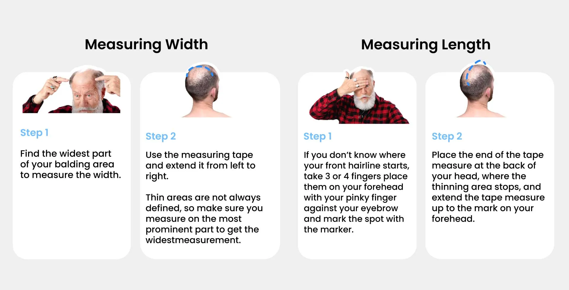 Measure your hair loss area
