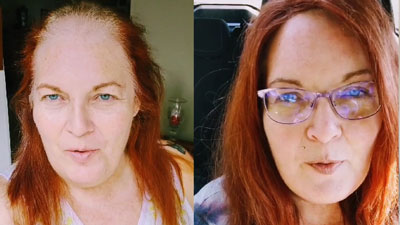 Human Hair Toppers for Women | Hair Pieces for Thinning Hair Human Hair Toppers for Women | Hair Pieces for Thinning Hair