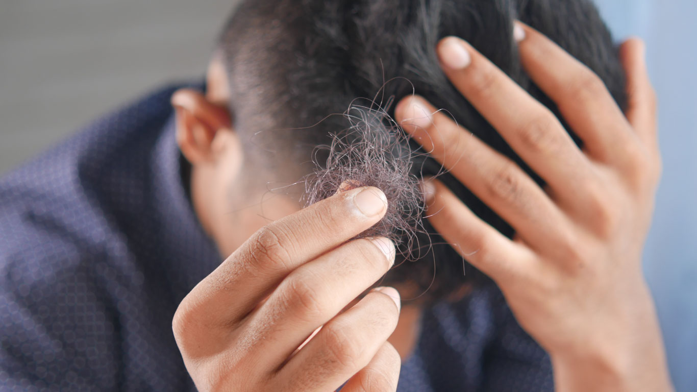 Hair shedding