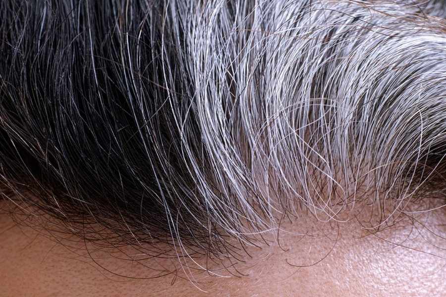 grey hair percentage