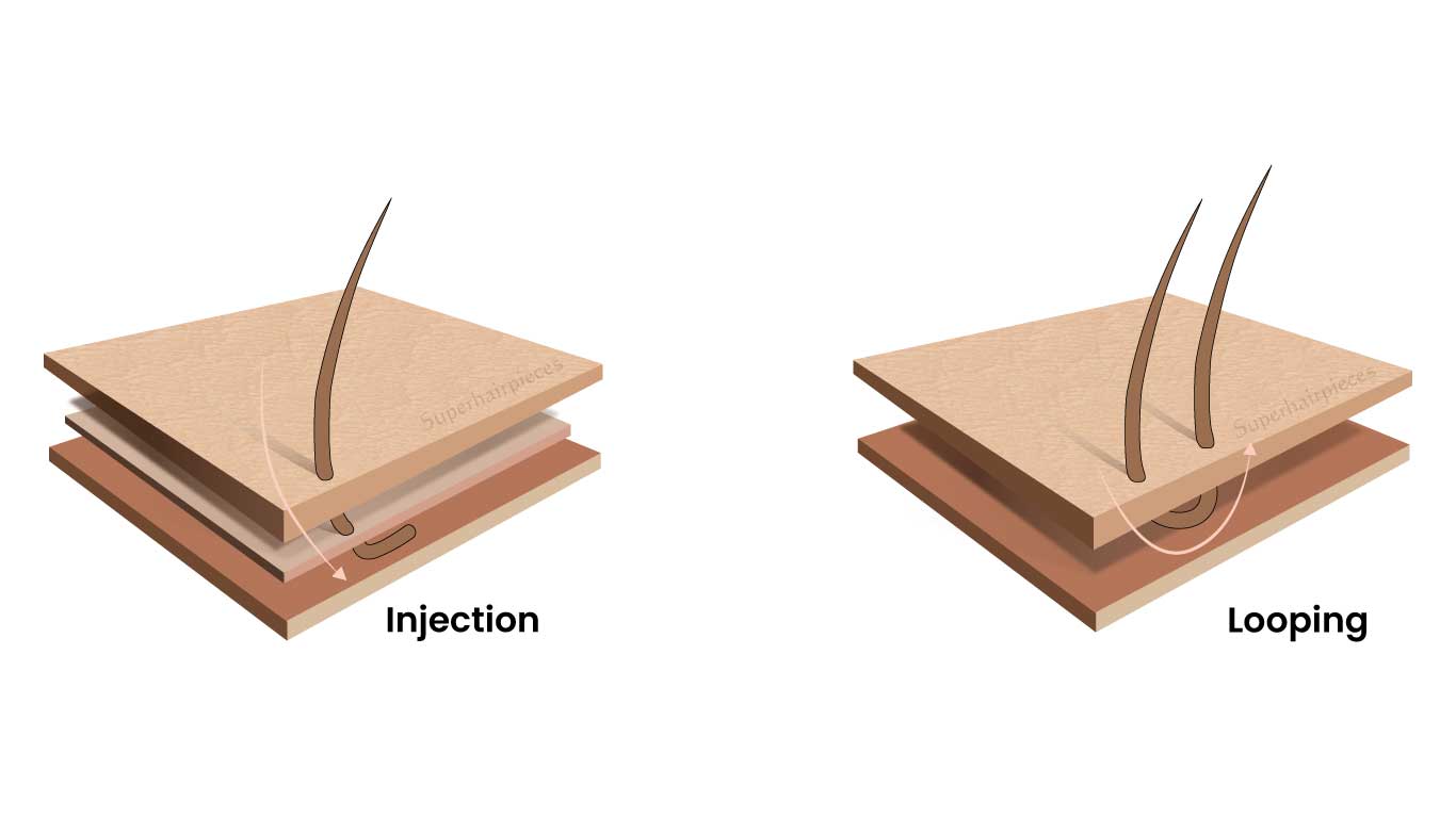 injected method