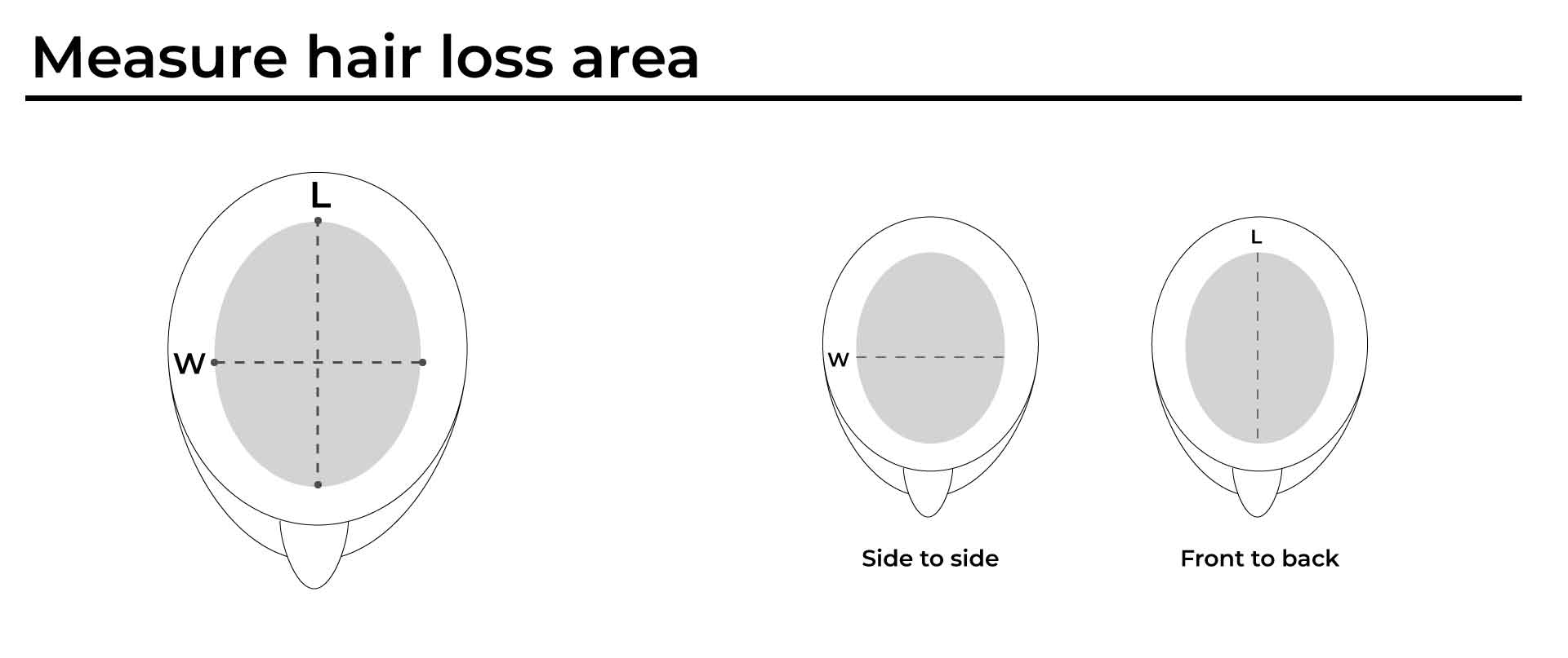 measure hair loss area